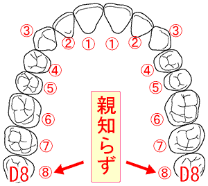 顎関節症治療に関係が深い親知らずと整体のお話 大阪府の西村歯科