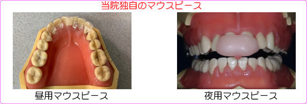 顎関節症治療 大阪堺の西村歯科スマートフォンサイト