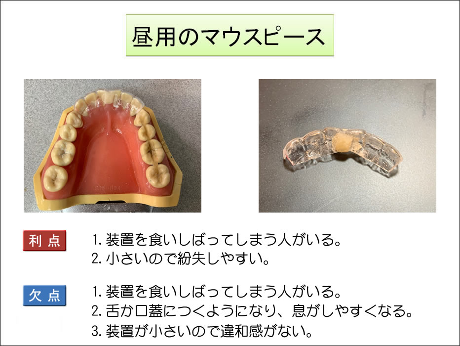 顎関節症治療 大阪堺の西村歯科スマートフォンサイト