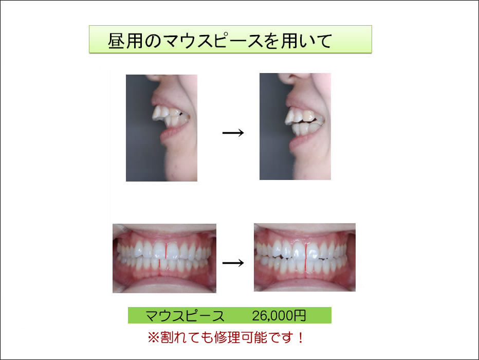 顎関節症治療 大阪堺の西村歯科スマートフォンサイト